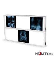 Negatoskop-mit-Acrylschirm-h1319